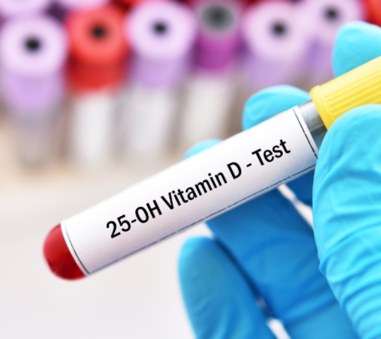 Exame de Vitamina D-25 Hidroxi