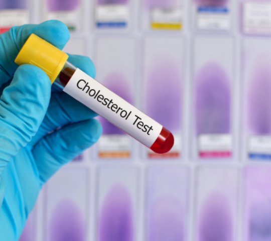 Exame de Colesterol Total