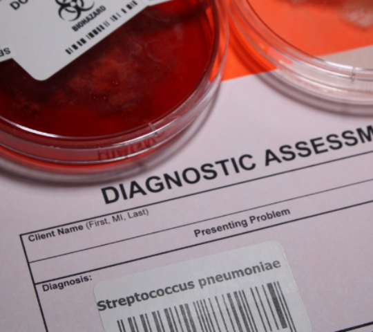 Estreptococo Grupo B