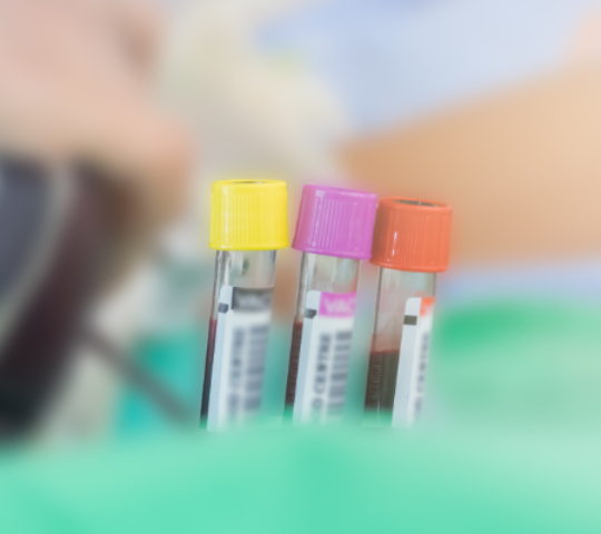 Prolactina Prolactina