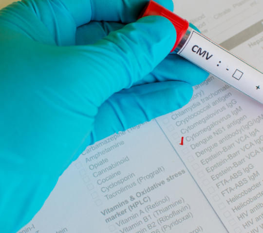 CMV – Citomegalovírus
